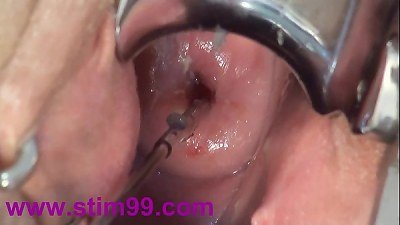 Cervix fuckin' play Deep chinese asian - &aring;&shy;Â&aring;&reg;&reg;&eacute;&nbsp;&cedil;&eacute;&fnof;&uml;&atilde;&sbquo;&macr;&atilde;&sbquo;&frac12;