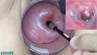 aged cougar Cervix play with Endoscope asian webcam into Uterus