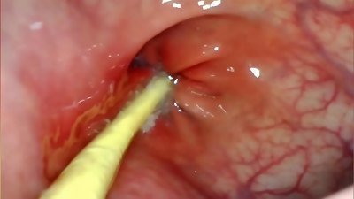 extraordinary anal invasion POV. CAMERA inwards HER anus AS I plow HER WITH MY thick manstick AND cum DEEP inside