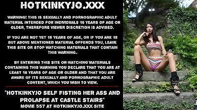 Hotkinkyjo self handballing her ass and prolapse at castle stairs